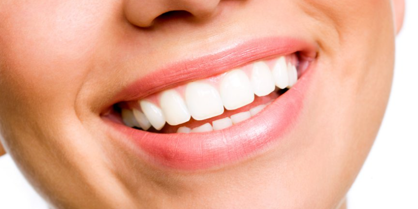 Blanqueamiento dental